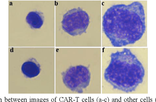 Figure 3 for RCMNet: A deep learning model assists CAR-T therapy for leukemia