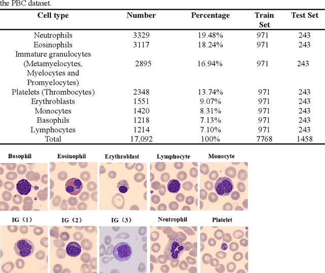 Figure 2 for RCMNet: A deep learning model assists CAR-T therapy for leukemia