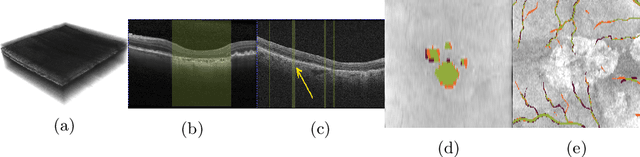 Figure 1 for Projective Skip-Connections for Segmentation Along a Subset of Dimensions in Retinal OCT