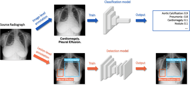 Figure 1 for Rethinking annotation granularity for overcoming deep shortcut learning: A retrospective study on chest radiographs