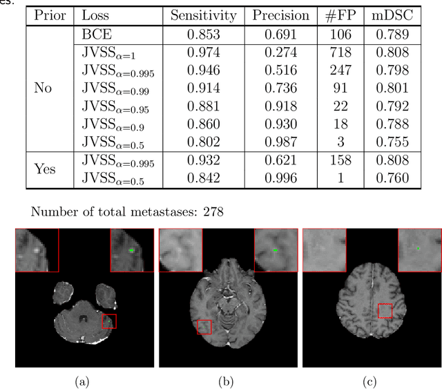 Figure 4 for Deep learning for brain metastasis detection and segmentation in longitudinal MRI data