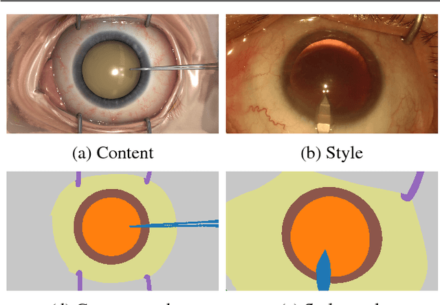 Figure 3 for SurReal: enhancing Surgical simulation Realism using style transfer