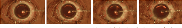 Figure 4 for SurReal: enhancing Surgical simulation Realism using style transfer