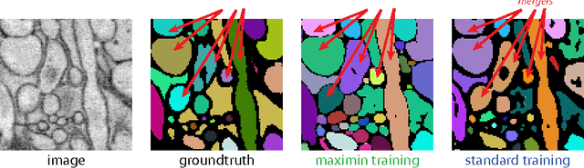 Figure 4 for Maximin affinity learning of image segmentation
