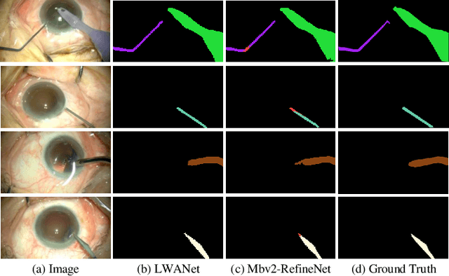 Figure 3 for Attention-Guided Lightweight Network for Real-Time Segmentation of Robotic Surgical Instruments
