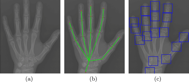 Figure 1 for Improve bone age assessment by learning from anatomical local regions