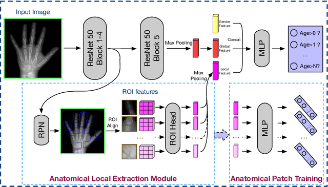 Figure 3 for Improve bone age assessment by learning from anatomical local regions