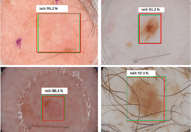 Figure 3 for A Multi-task Framework for Skin Lesion Detection and Segmentation