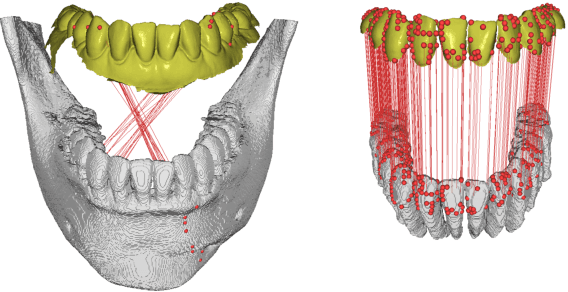 Figure 4 for Fully automatic integration of dental CBCT images and full-arch intraoral impressions with stitching error correction via individual tooth segmentation and identification