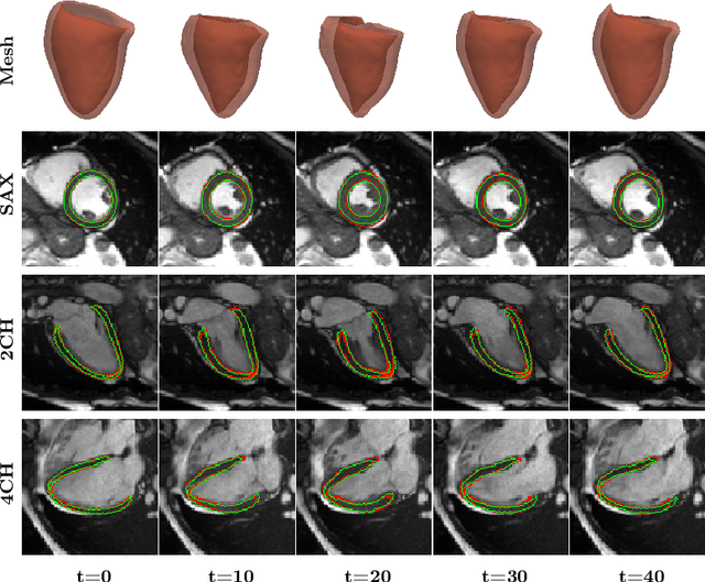 Figure 3 for Mesh-based 3D Motion Tracking in Cardiac MRI using Deep Learning