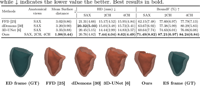 Figure 2 for Mesh-based 3D Motion Tracking in Cardiac MRI using Deep Learning
