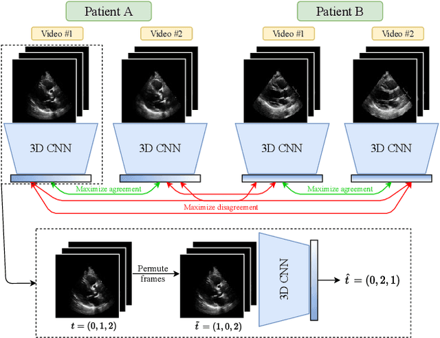 Figure 1 for Self-Supervised Learning of Echocardiogram Videos Enables Data-Efficient Clinical Diagnosis