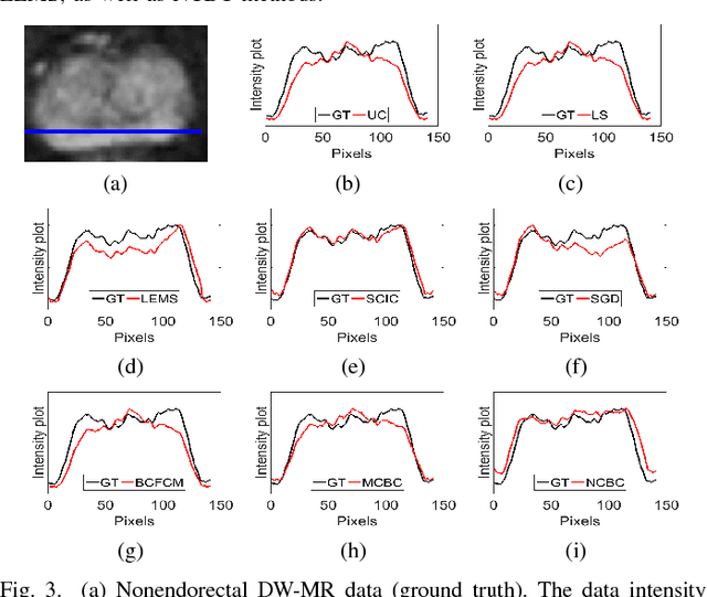 Figure 3 for Noise-Compensated, Bias-Corrected Diffusion Weighted Endorectal Magnetic Resonance Imaging via a Stochastically Fully-Connected Joint Conditional Random Field Model