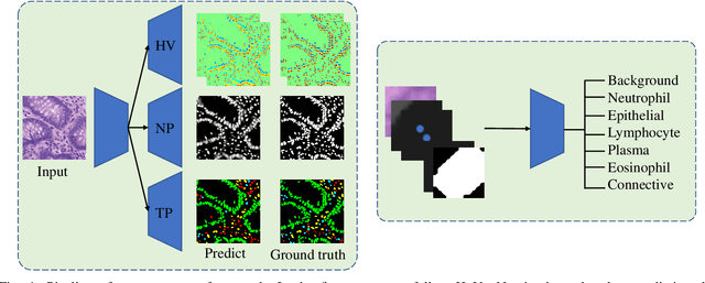 Figure 1 for AugHover-Net: Augmenting Hover-net for Nucleus Segmentation and Classification