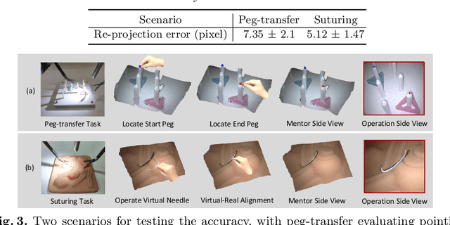 Figure 3 for Robotic Surgery Remote Mentoring via AR with 3D Scene Streaming and Hand Interaction