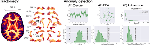 Figure 1 for Tractometry-based Anomaly Detection for Single-subject White Matter Analysis