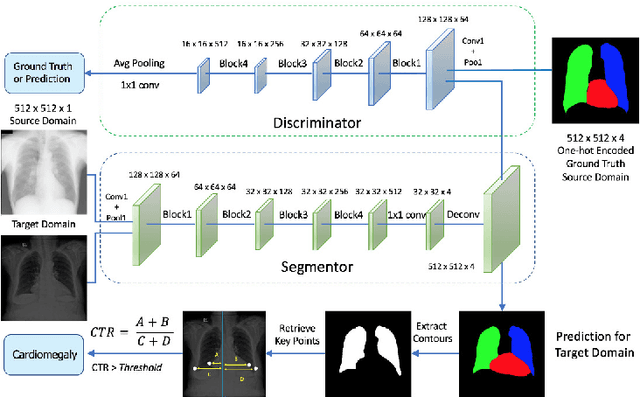 Figure 1 for Unsupervised Domain Adaptation for Automatic Estimation of Cardiothoracic Ratio