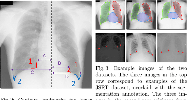 Figure 4 for Unsupervised Domain Adaptation for Automatic Estimation of Cardiothoracic Ratio