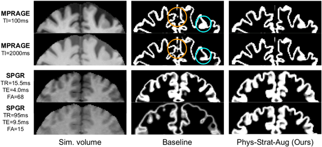Figure 4 for The role of MRI physics in brain segmentation CNNs: achieving acquisition invariance and instructive uncertainties