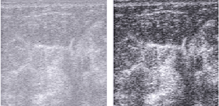 Figure 1 for Tumour Ellipsification in Ultrasound Images for Treatment Prediction in Breast Cancer