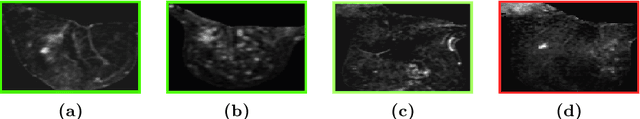 Figure 3 for Training Medical Image Analysis Systems like Radiologists