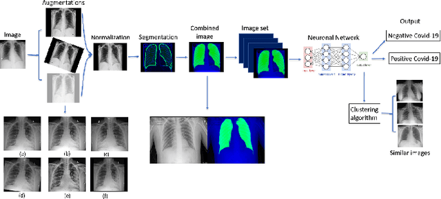 Figure 1 for Point of Care Image Analysis for COVID-19