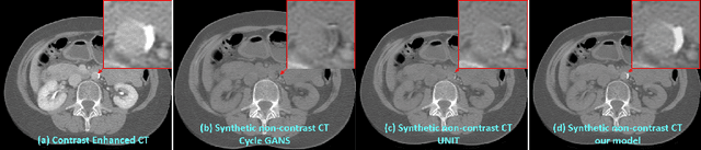 Figure 1 for Cross-Domain Medical Image Translation by Shared Latent Gaussian Mixture Model