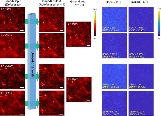 Figure 3 for Single-shot autofocusing of microscopy images using deep learning