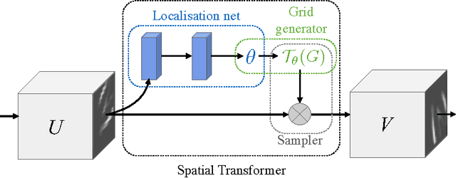 Figure 3 for Spatial Transformer Networks