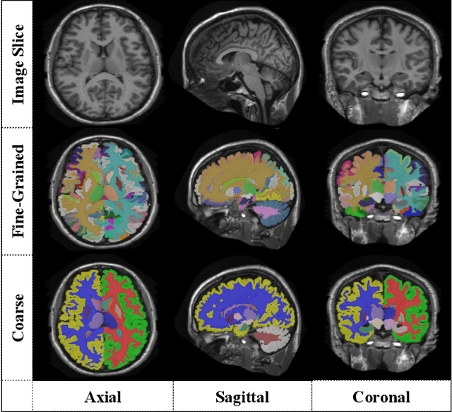Figure 1 for Feature-Fused Context-Encoding Network for Neuroanatomy Segmentation