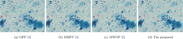 Figure 1 for Efficient Misalignment-Robust Multi-Focus Microscopical Images Fusion