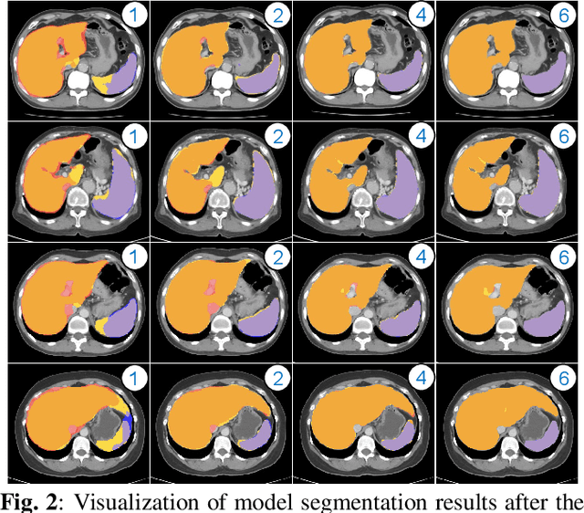Figure 2 for Rapid model transfer for medical image segmentation via iterative human-in-the-loop update: from labelled public to unlabelled clinical datasets for multi-organ segmentation in CT