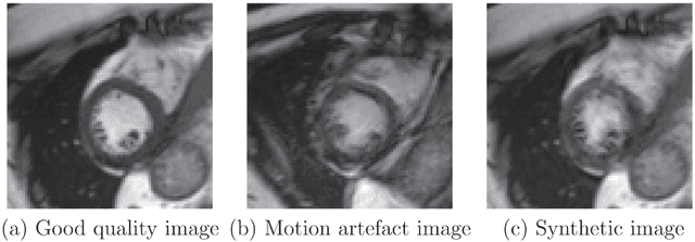 Figure 1 for Automatic CNN-based detection of cardiac MR motion artefacts using k-space data augmentation and curriculum learning