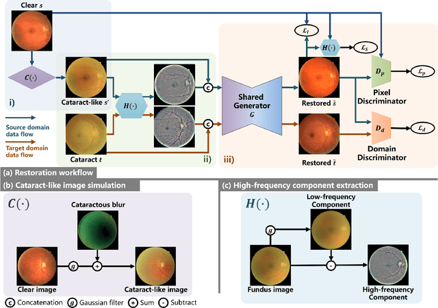 Figure 3 for An Annotation-free Restoration Network for Cataractous Fundus Images