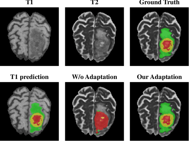Figure 1 for Cross-Modality Brain Tumor Segmentation via Bidirectional Global-to-Local Unsupervised Domain Adaptation