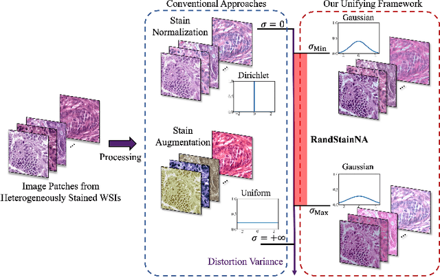 Figure 1 for RandStainNA: Learning Stain-Agnostic Features from Histology Slides by Bridging Stain Augmentation and Normalization