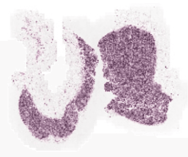 Figure 3 for TriResNet: A Deep Triple-stream Residual Network for Histopathology Grading