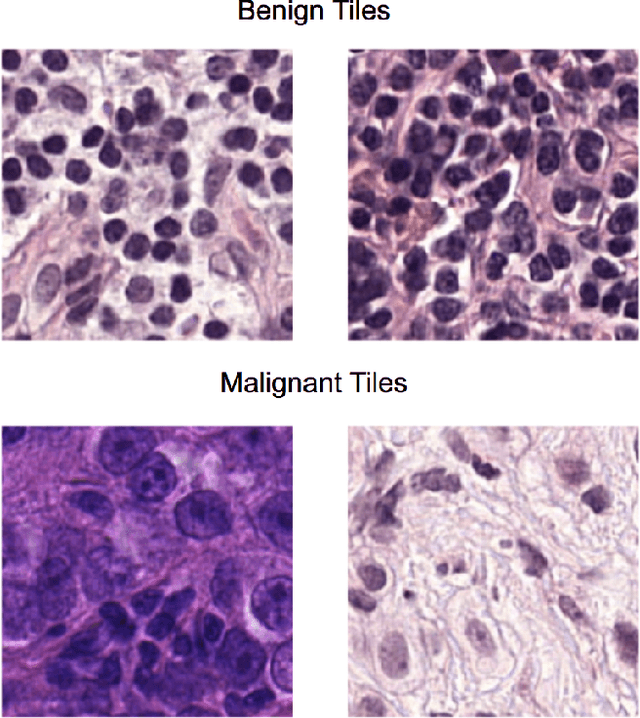 Figure 4 for TriResNet: A Deep Triple-stream Residual Network for Histopathology Grading