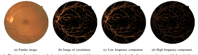 Figure 1 for Accurate Retinal Vessel Segmentation via Octave Convolution Neural Network