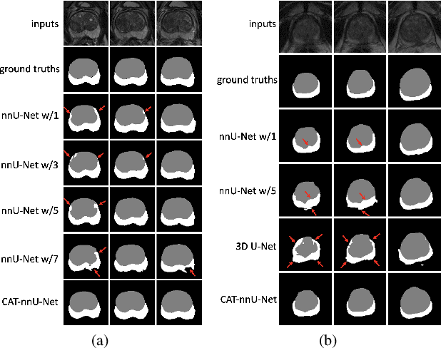 Figure 4 for CAT-Net: A Cross-Slice Attention Transformer Model for Prostate Zonal Segmentation in MRI
