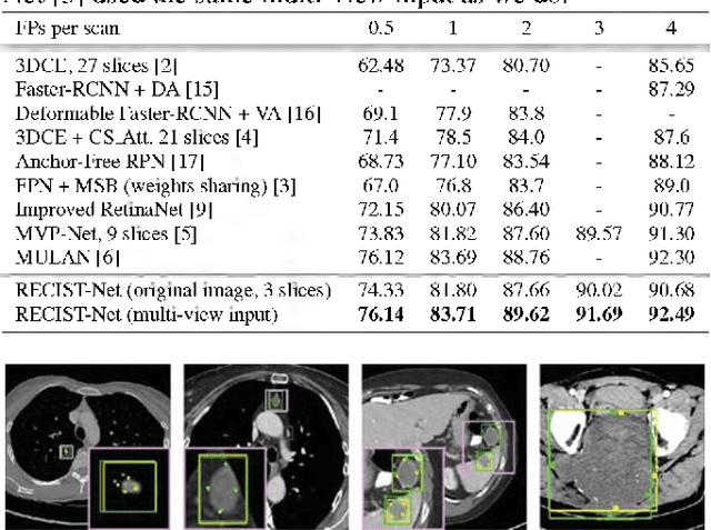 Figure 2 for RECIST-Net: Lesion detection via grouping keypoints on RECIST-based annotation