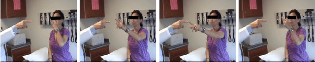 Figure 1 for A Video-Based Method for Objectively Rating Ataxia