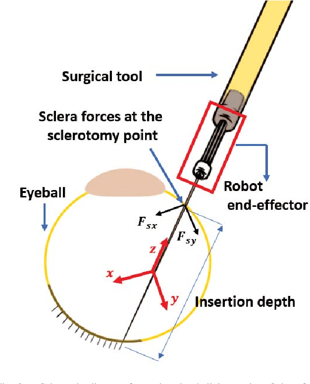 Figure 2 for Sclera Force Control in Robot-assisted Eye Surgery: Adaptive Force Control vs. Auditory Feedback