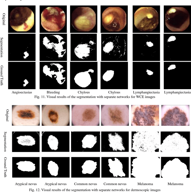 Figure 3 for Multiple Abnormality Detection for Automatic Medical Image Diagnosis Using Bifurcated Convolutional Neural Network