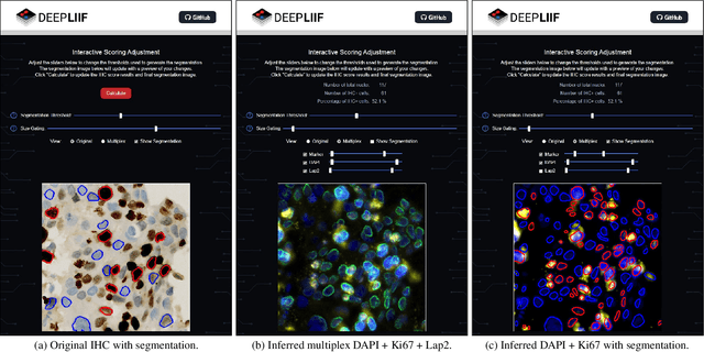 Figure 4 for DeepLIIF: An Online Platform for Quantification of Clinical Pathology Slides