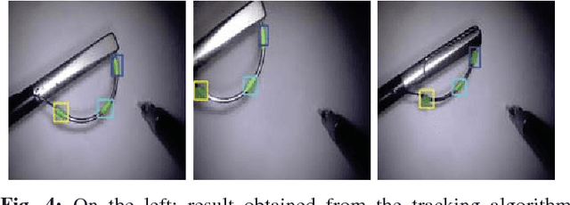 Figure 4 for Automated pick-up of suturing needles for robotic surgical assistance