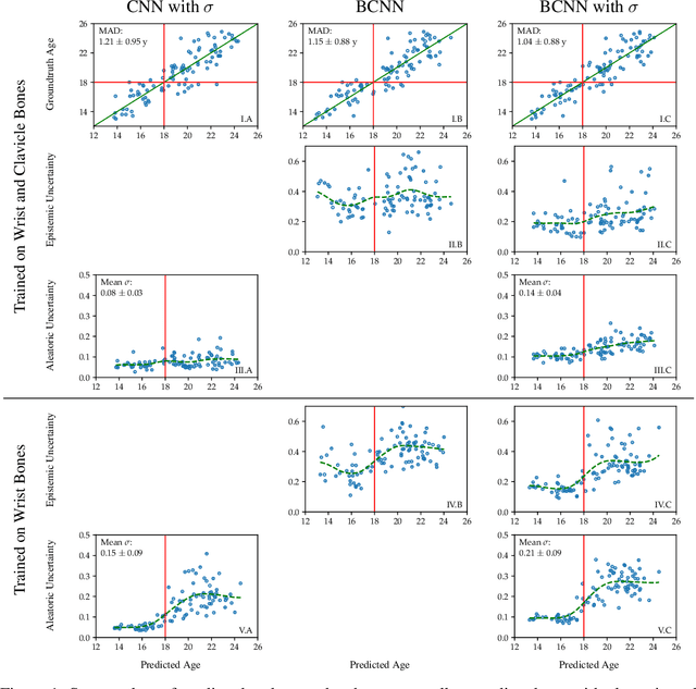 Figure 1 for Variational Inference and Bayesian CNNs for Uncertainty Estimation in Multi-Factorial Bone Age Prediction