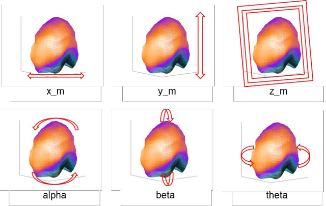 Figure 1 for Automatic reorientation by deep learning to generate short axis SPECT myocardial perfusion images