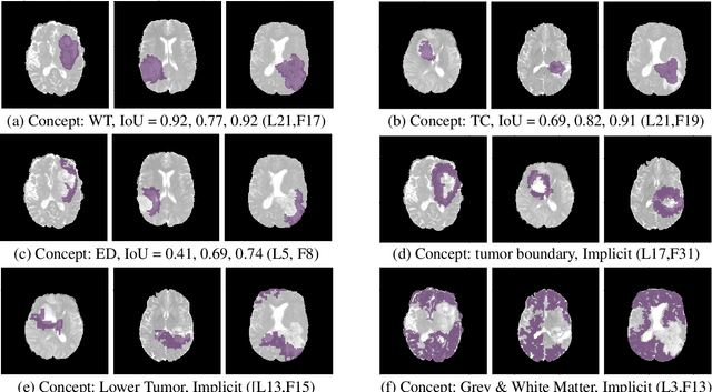 Figure 2 for Demystifying Brain Tumour Segmentation Networks: Interpretability and Uncertainty Analysis