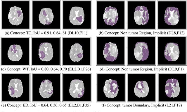Figure 3 for Demystifying Brain Tumour Segmentation Networks: Interpretability and Uncertainty Analysis